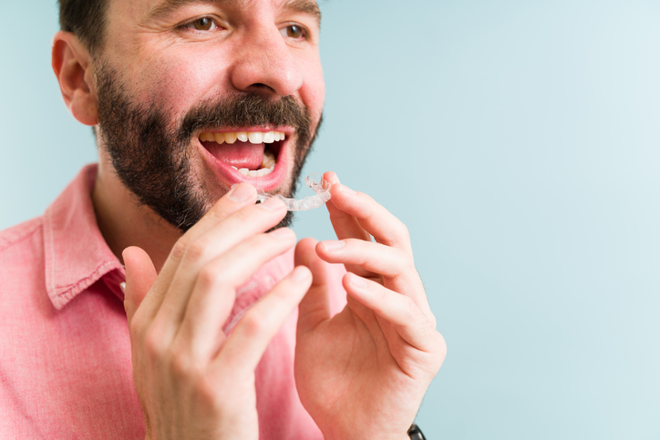 A man opening his mouth wide to insert the upper row of his Invisalign Invisaligners.