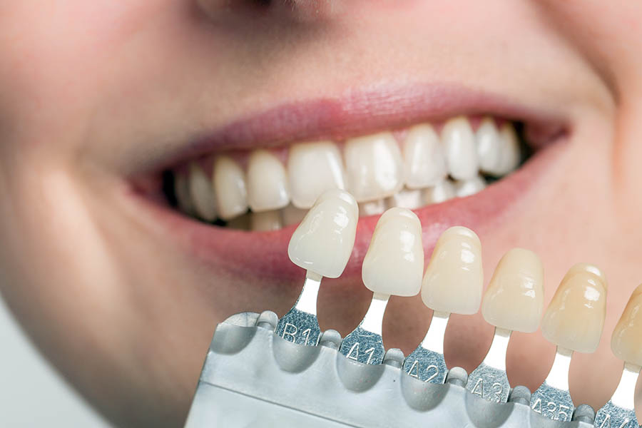 A dentist using a shade guide next to a woman's teeth to check veneer shade.