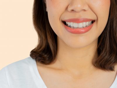 close up young beautiful asian woman smiling with dental aligner retainer tool (invisalign) isolated on cream color background of dental clinic for beautiful teeth treatment course concept.